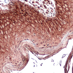 E-Cadherin antibody