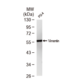 Vimentin antibody [GT7812]