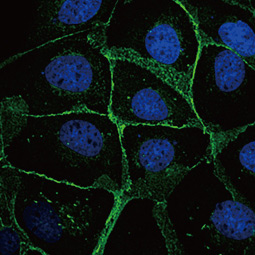 beta Catenin antibody [N1N2-2], N-term