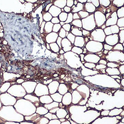 Perilipin 1 antibody