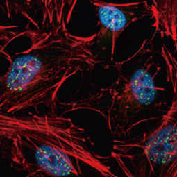 ROR alpha antibody [C3], C-term (GTX108201)