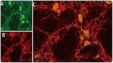 ASIC1 antibody