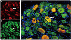 ASIC3 antibody