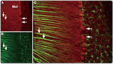 Cav2.1 antibody