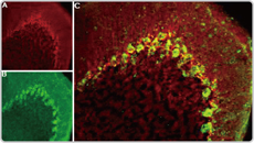 Cav3.2 antibody