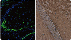 DPP6 antibody