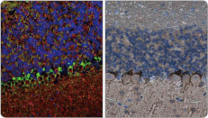 HCN1 antibody