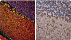 IP3 Receptor I antibody