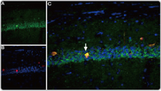 Nav1.6 antibody