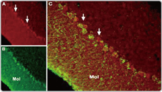 TRPC6 antibody