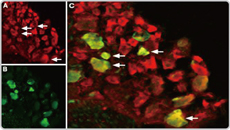 TRPV1 antibody