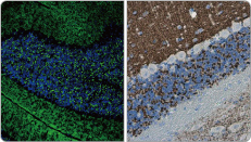 VGluT1 antibody