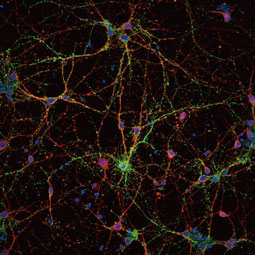 Synaptophysin antibody (GTX100865)