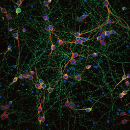 Tau antibody(GTX130462)