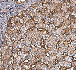 Apolipoprotein E antibody