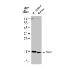 HIP1 antibody