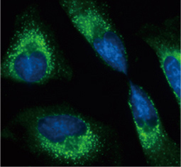 Grp78 antibody (GTX113340)