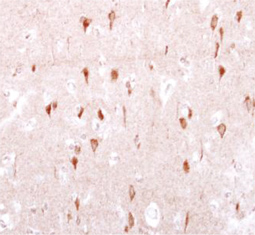 LRRK2 antibody (GTX113065)