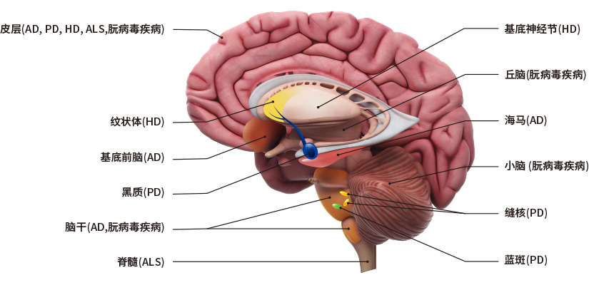 Neurodegenerative Disorders