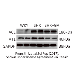 ACE antibody(GTX100923)