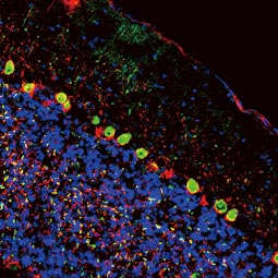 Calcitonin antibody(GTX134005)