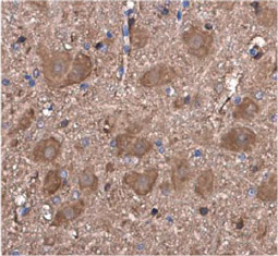 Choline Acetyltransferase antibody [N1N3]