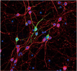 GABA antibody GTX125988