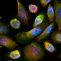 beta 2 Adrenergic Receptor antibody [HL3594]