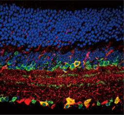 Vesicular Acetylcholine Transporter antibody