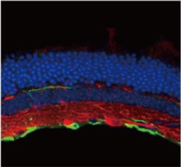 Calretinin antibody