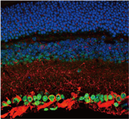 PKC alpha antibody