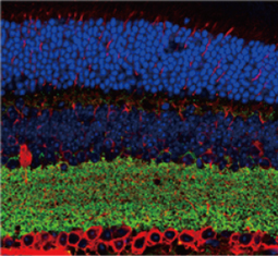 S100 beta antibody