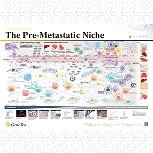 The Pre-Metastatic Niche
