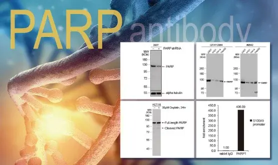 PARP antibody