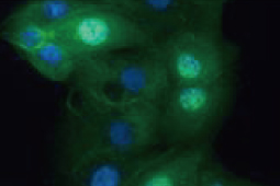 Article alert: Proteomic Analysis Reveals How RNA Viruses Remodel Host Polysomes