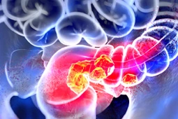 Article Alert: Targeting the MMP-2/TYRO3/BRD3 Axis Ameliorates Colorectal Cancer Malignancy