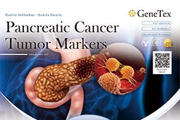 Pancreatic Cancer Tumor Markers