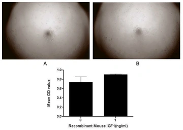 Mouse IGF1 protein, His tag (active). GTX00049-pro