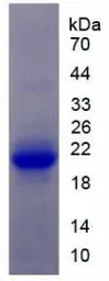 Rat IL1 Receptor 1 protein, His tag. GTX00053-pro