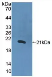 Human IL1 alpha protein, His tag (active). GTX00067-pro