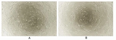 Human IL1 alpha protein, His tag (active). GTX00067-pro