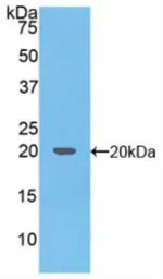 Human TRAIL protein, His tag. GTX00068-pro