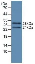 Human Prolactin protein, His tag (active). GTX00069-pro
