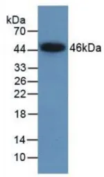 Human LMTK3 protein, His and SUMO tag (active). GTX00071-pro