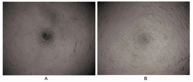 Human LMTK3 protein, His and SUMO tag (active). GTX00071-pro