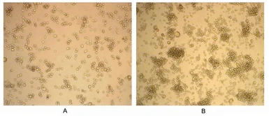 Human GM-CSF protein, His tag (active). GTX00082-pro