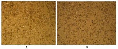 Human GM-CSF protein, His tag (active). GTX00082-pro
