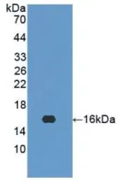 Human Interferon gamma protein, His tag (active). GTX00083-pro