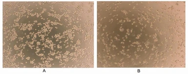 Human Interferon gamma protein, His tag (active). GTX00083-pro