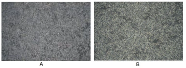 Human Interferon gamma protein, His tag (active). GTX00084-pro